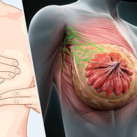 Anatomía del seno para TR, mamografistas y Sonografistas 