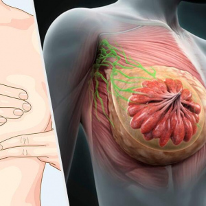 Anatomía del seno para TR, mamografistas y Sonografistas 